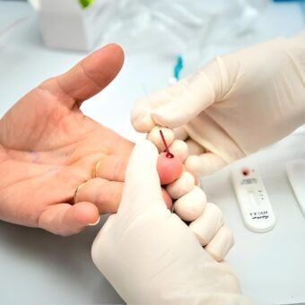  Aumento de ISTs após Carnaval: diagnóstico e atendimento em Osasco